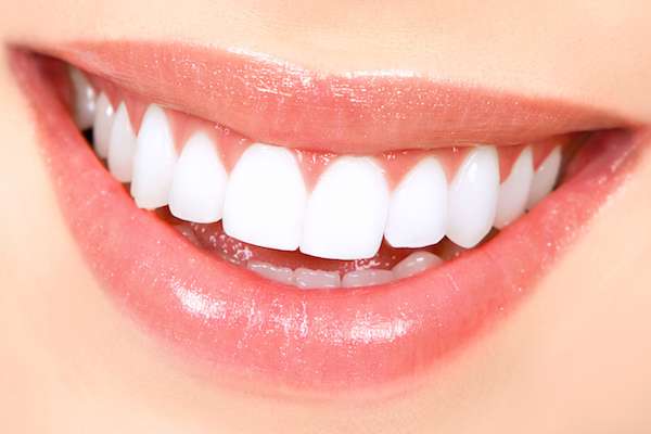 How Long Does Teeth Whitening Take