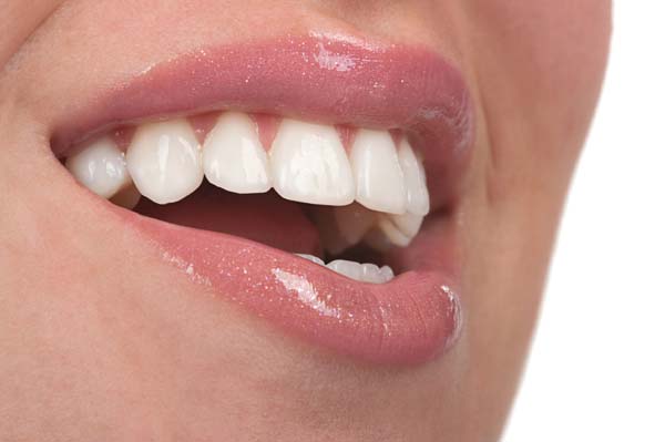 Ways A Smile Makeover Can Improve Your Smile