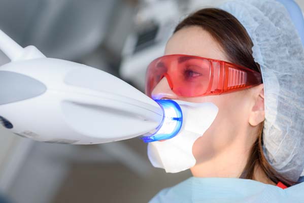 Understanding Professional Teeth Whitening